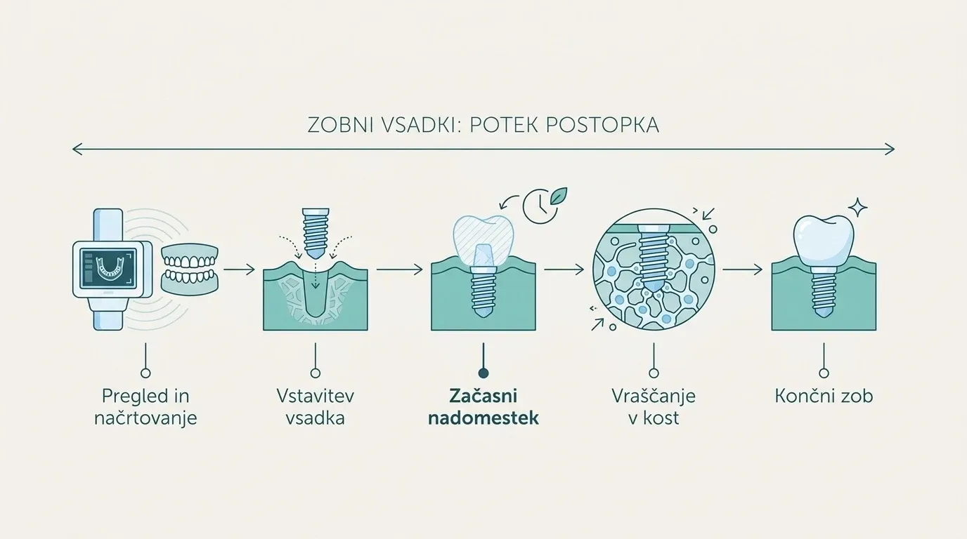 Shematski prikaz korakov do zobnega vsadka, od prvega pregleda in začasnega zoba med celjenjem do namestitve končne krone.